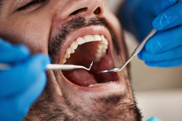 Best Dental Inlays and Onlays  in Hebron, MD